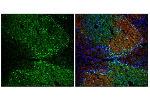 Immunofluorescence Image 1: STING (E9X7F) Rabbit mAb (Alexa Fluor<sup>®</sup> 488 Conjugate)