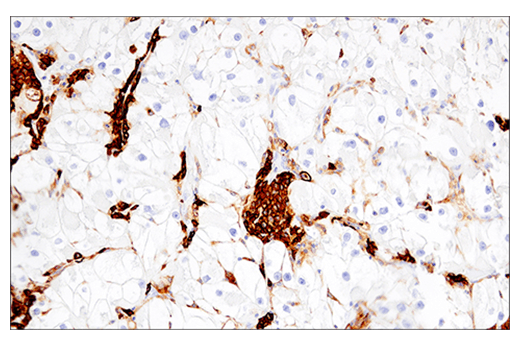 Immunohistochemistry Image 4: CD38 (E7Z8C) XP<sup>®</sup> Rabbit mAb