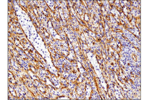 Immunohistochemistry Image 4: IFITM3 (D8E8G) XP<sup>®</sup> Rabbit mAb (BSA and Azide Free)