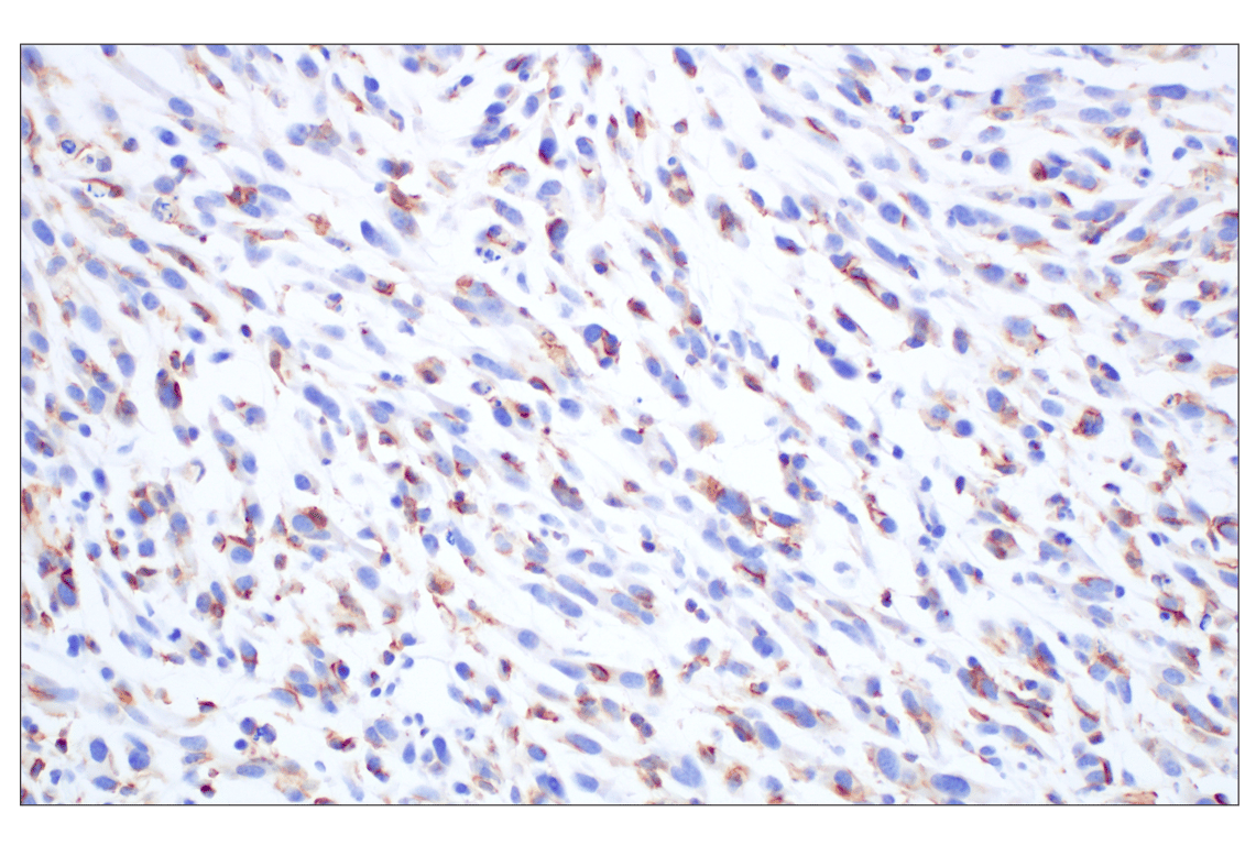 Immunohistochemistry Image 2: Siglec-1/CD169 (E1D7G) Rabbit mAb