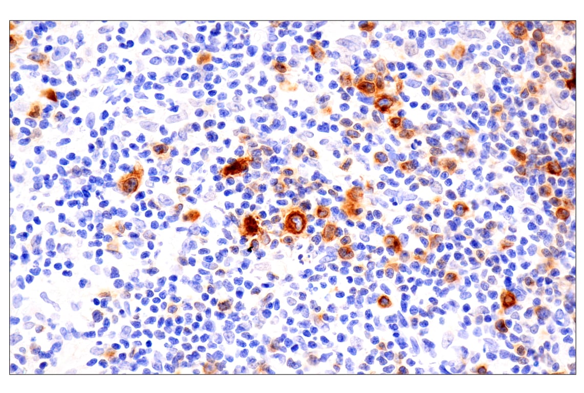 Immunohistochemistry Image 1: TNFRSF8/CD30 (E4L4I) XP<sup>®</sup> Rabbit mAb (BSA and Azide Free)