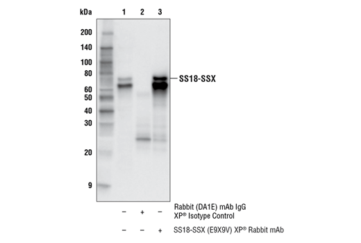 undefined Image 21: BAF Complex IHC Antibody Sampler Kit