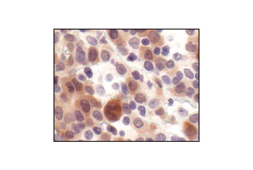 Immunohistochemistry Image 3: Phospho-4E-BP1 (Thr37/46) (236B4) Rabbit mAb (BSA and Azide Free)