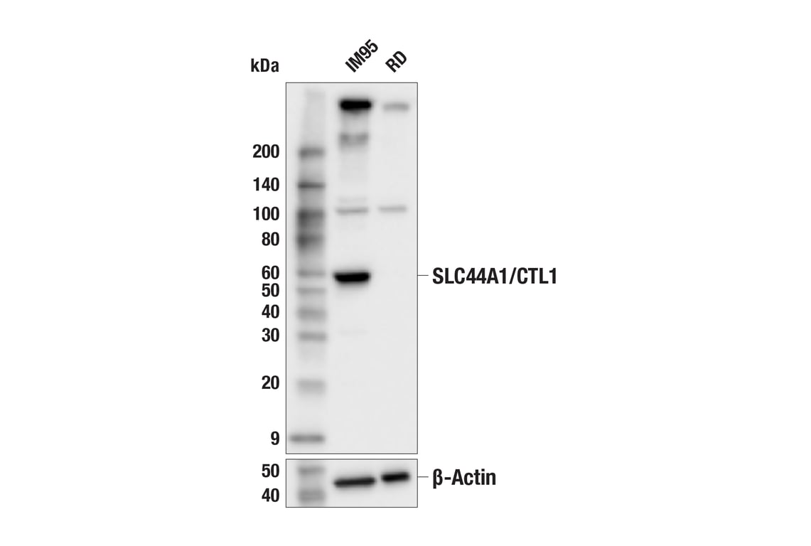 Western Blotting Image 2: SLC44A1 (F8D3V) Rabbit mAb