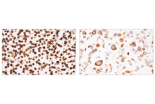 Immunohistochemistry Image 10: CD38 (E7Z8C) XP<sup>®</sup> Rabbit mAb