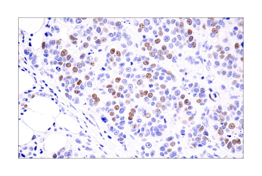 Immunohistochemistry Image 4: ATAD2 (E8Y7F) Rabbit mAb