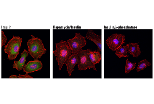 Immunofluorescence Image 1: Phospho-CAD (Ser1859) (D5O6C) Rabbit mAb