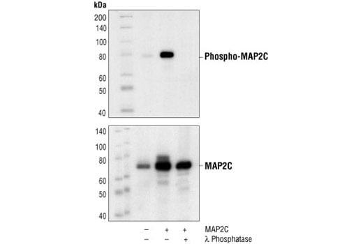Western Blotting Image 1: Phospho-MAP2 (Thr1620/1623) Antibody