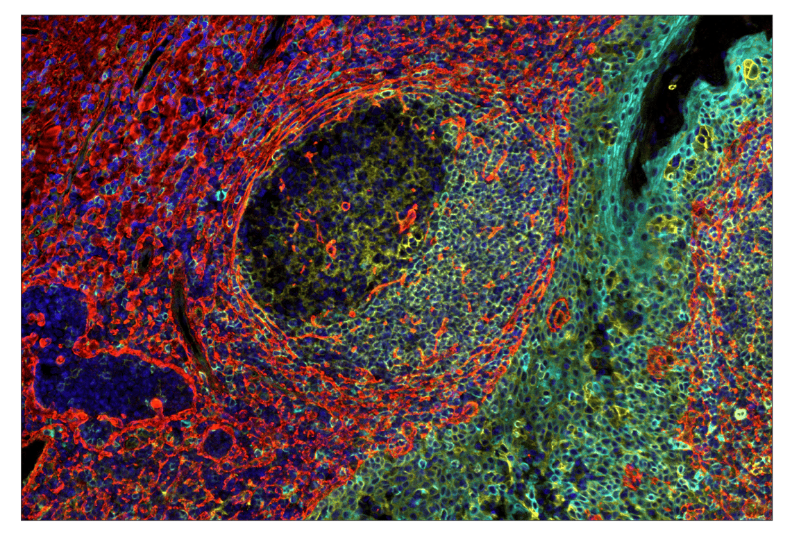 Immunohistochemistry Image 1: CD40 (D8W3N) & CO-0115-647 SignalStar<sup>™</sup> Oligo-Antibody Pair