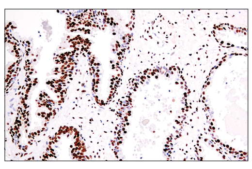 Immunohistochemistry Image 6: ADAR1 (E6X9R) XP<sup>®</sup> Rabbit mAb