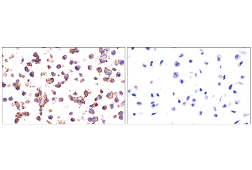 Immunohistochemistry Image 5: CD4 (EP204) Rabbit mAb