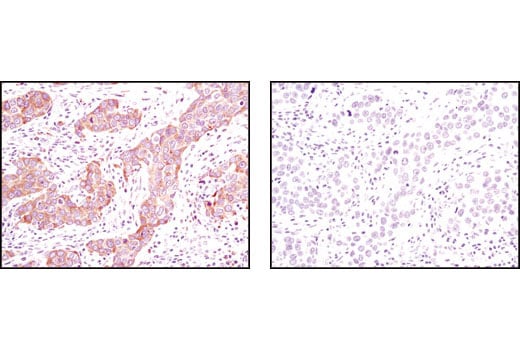 undefined Image 18: MHC Class I Antigen Processing and Presentation Antibody Sampler Kit