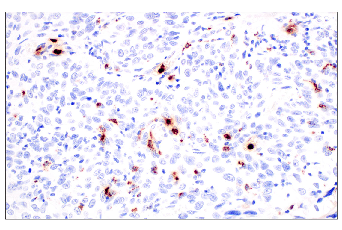 Immunohistochemistry Image 3: Neutrophil Elastase (F4H3X) Rabbit mAb (BSA and Azide Free)