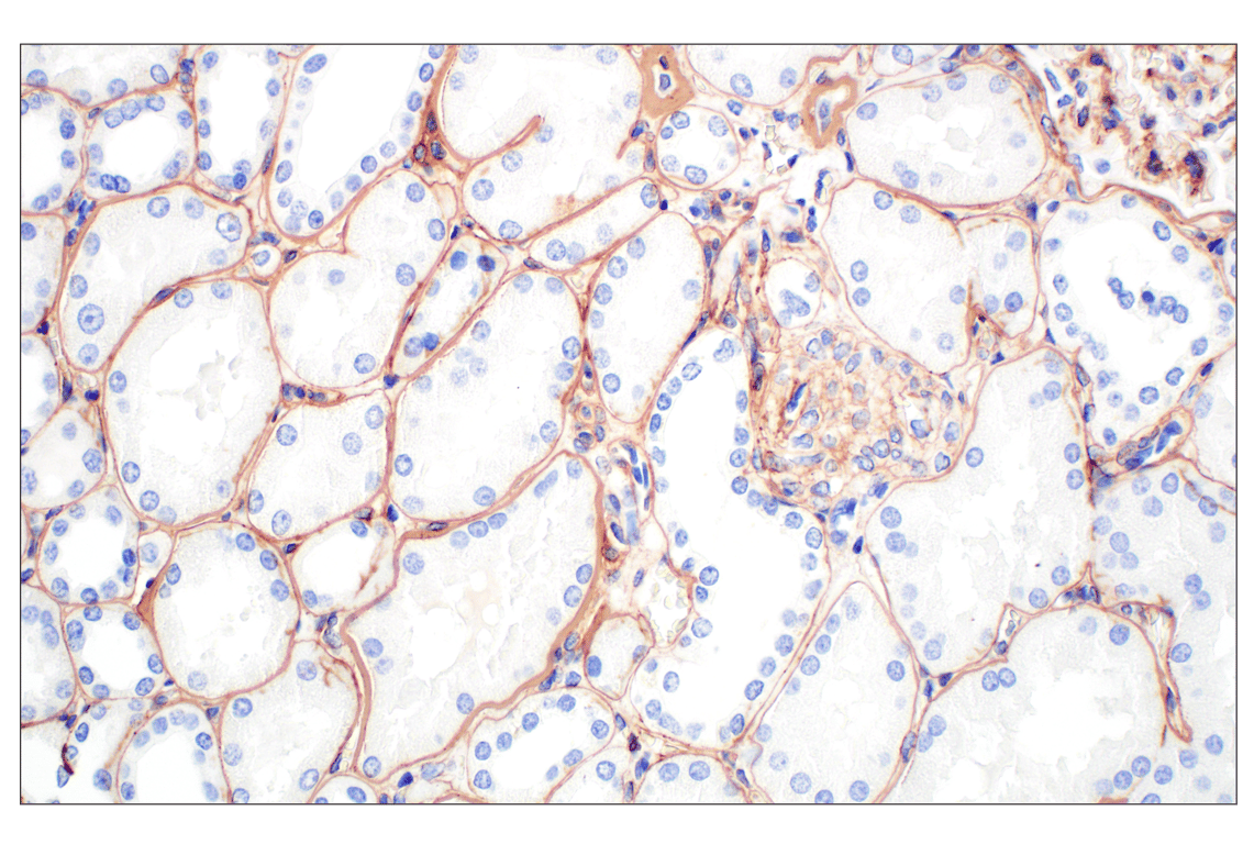 Immunohistochemistry Image 6: COL4A1 (E5M6R) Rabbit mAb (IHC Formulated)