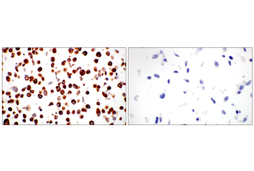 Immunohistochemistry Image 10: COL14A1 (E5W8S) Rabbit mAb (BSA and Azide Free)