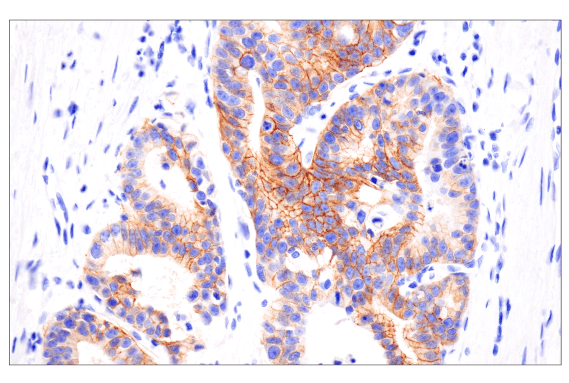 Immunohistochemistry Image 3: FGF Receptor 2 (D4L2V) Rabbit mAb (BSA and Azide Free)