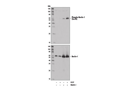 Western Blotting Image 2: Phospho-Beclin-1 (Ser93) (D9A5G) Rabbit mAb