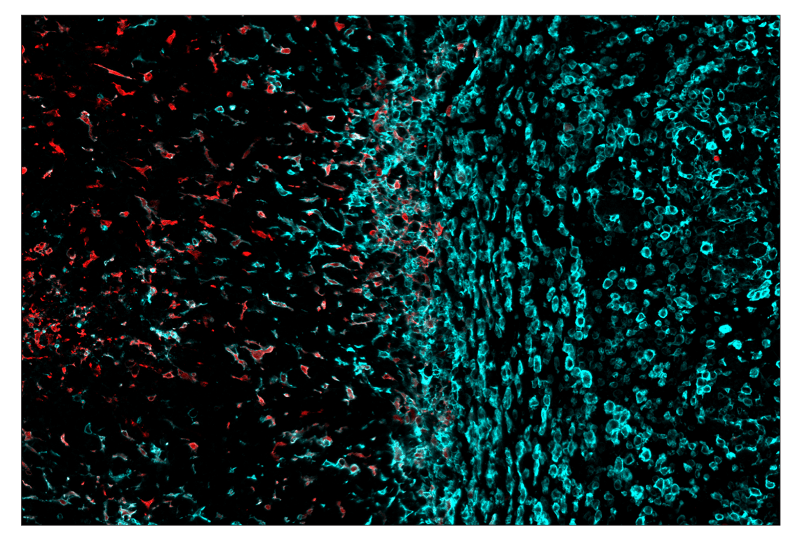 Immunohistochemistry Image 6: Arginase-1 (D4E3M) & CO-0075-750 SignalStar<sup>™</sup> Oligo-Antibody Pair