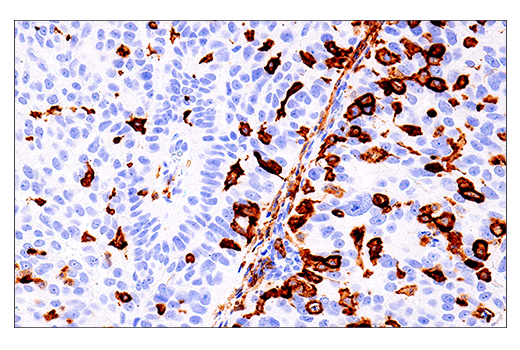 Immunohistochemistry Image 1: LAIR-1 (E7X6I) XP<sup>®</sup> Rabbit mAb (BSA and Azide Free)