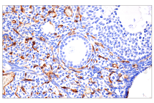 Immunohistochemistry Image 5: CD38 (E9F5A) XP<sup>®</sup> Rabbit mAb