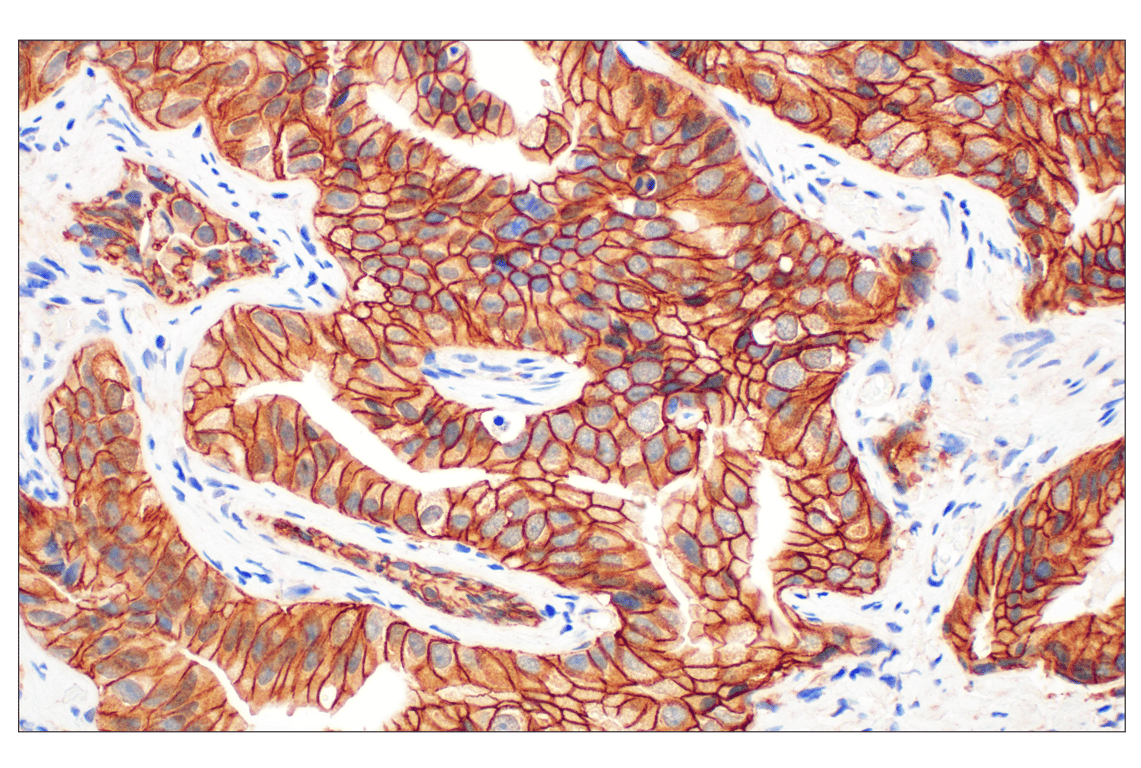 undefined Image 16: Cadherin-Catenin Antibody Sampler Kit