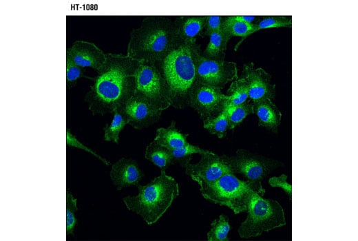 Immunofluorescence Image 1: DR5 (D4E9) XP<sup>®</sup> Rabbit mAb