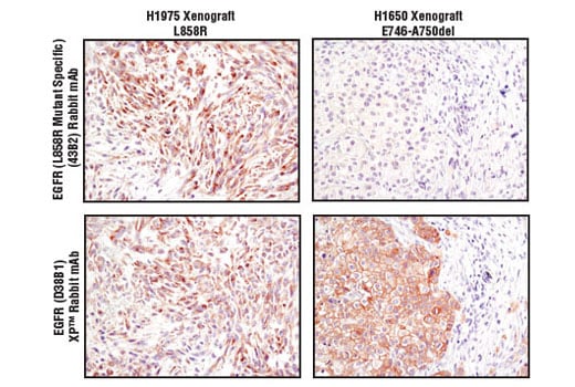 Immunohistochemistry Image 1: EGF Receptor (L858R Mutant Specific) (43B2) Rabbit mAb (BSA and Azide Free)