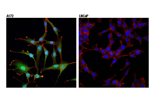 Immunofluorescence Image 1: Akt3 (E1Z3W) Rabbit mAb