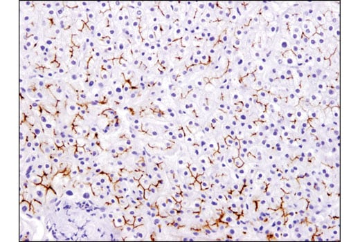 Immunohistochemistry Image 2: MDR1/ABCB1 (E1Y7S) Rabbit mAb