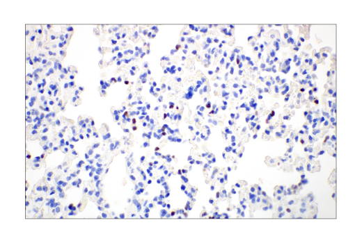 Immunohistochemistry Image 7: T-bet/TBX21 (E4I2K) Rabbit mAb