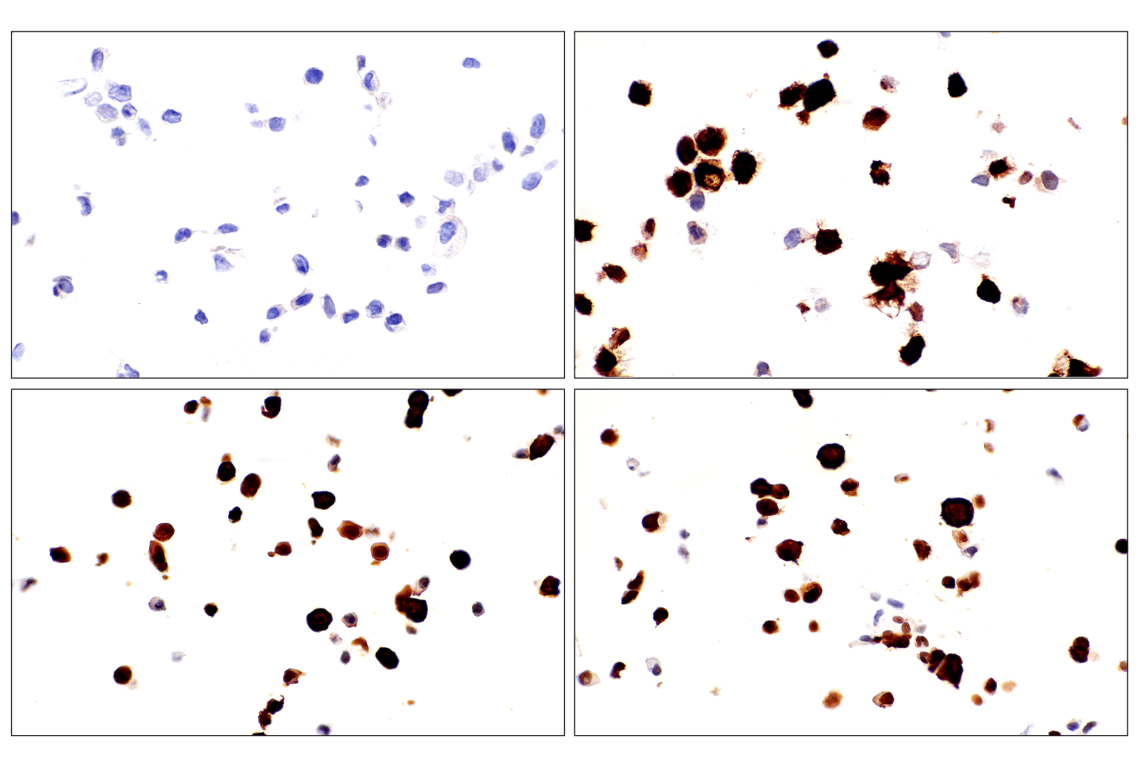 Immunohistochemistry Image 13: ADAR1 p150 Isoform   (E6U1U) Rabbit mAb   (BSA and Azide Free)