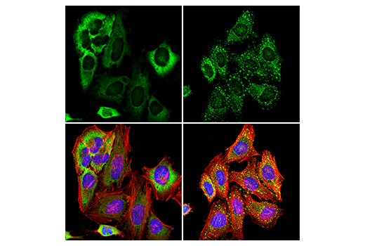 Immunofluorescence Image 1: G3BP1 (E9G1M) XP<sup>®</sup> Rabbit mAb