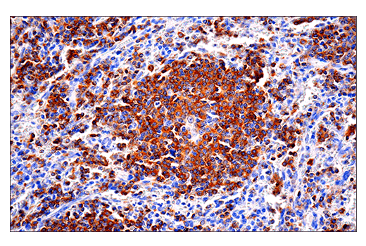 Immunohistochemistry Image 1: CD22 (E7L6Z) XP<sup>®</sup> Rabbit mAb (BSA and Azide Free)