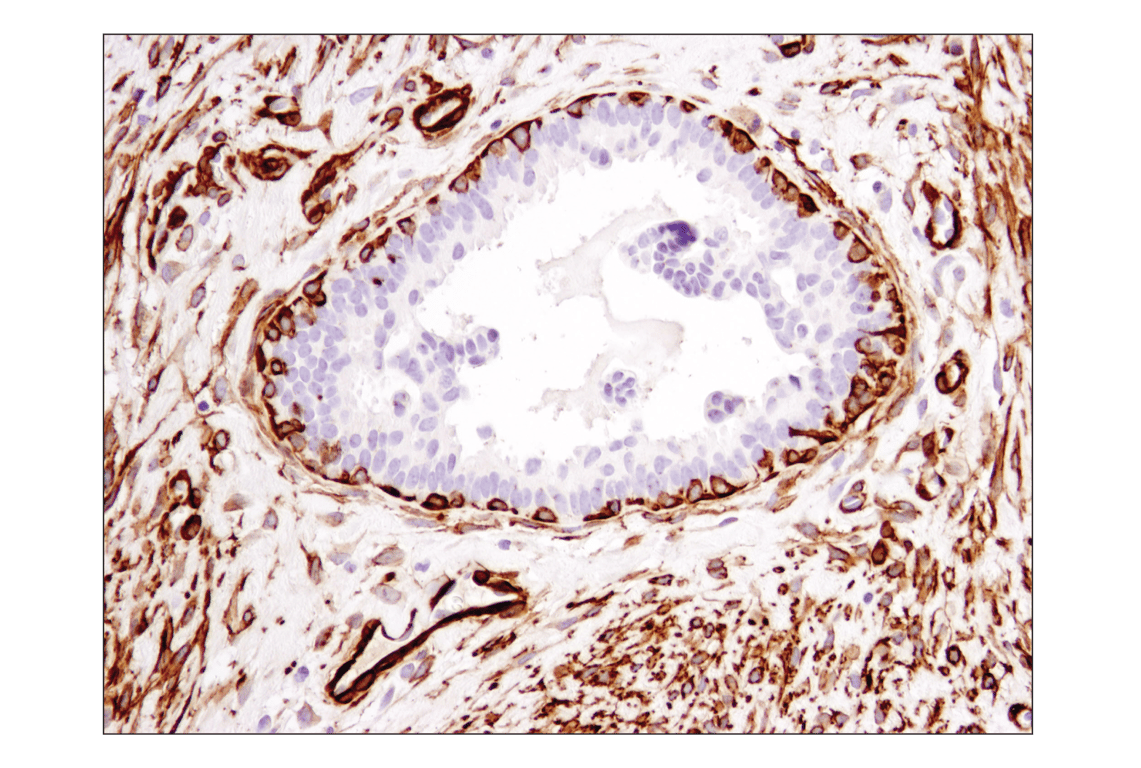 Immunohistochemistry Image 5: α-Smooth Muscle Actin (1A4) Mouse mAb (BSA and Azide Free)