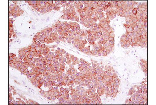 Immunohistochemistry Image 3: Met (D1C2) XP<sup>®</sup> Rabbit mAb (BSA and Azide Free)