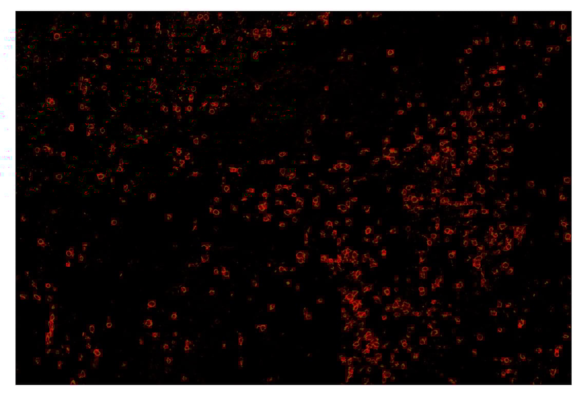 Immunohistochemistry Image 4: CD8α (D8A8Y) & CO-0004-647 SignalStar<sup>™</sup> Oligo-Antibody Pair