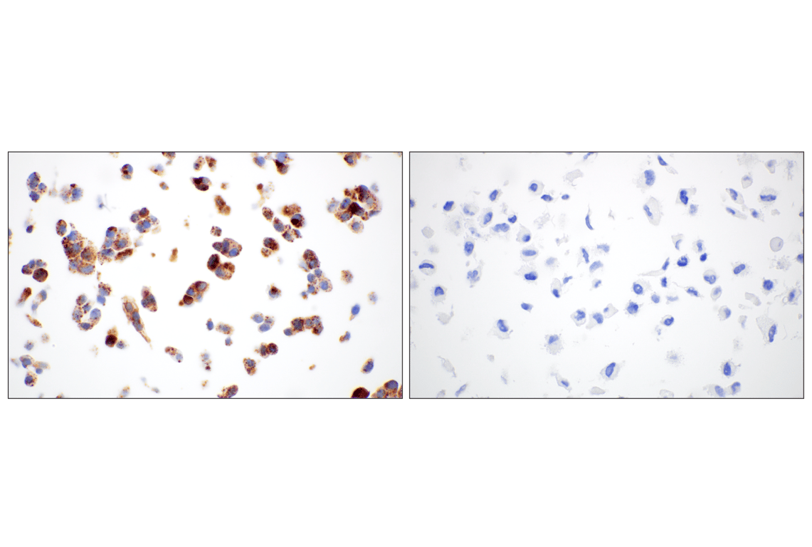 Immunohistochemistry Image 16: Perilipin-2 (E6G6M) Rabbit mAb