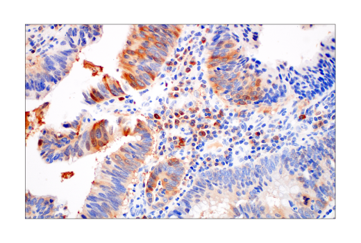 Immunohistochemistry Image 3: Asparagine Synthetase (E6C2C) XP<sup>®</sup> Rabbit mAb (BSA and Azide Free)