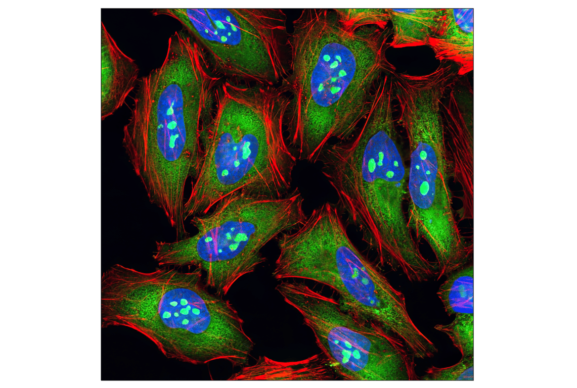 Immunofluorescence Image 1: S6 Ribosomal Protein (54D2) Mouse mAb (Alexa Fluor<sup>®</sup> 488 Conjugate)