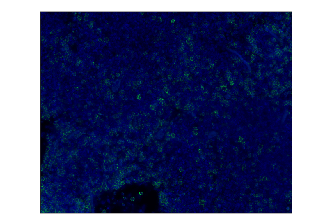 Immunohistochemistry Image 1: CD20 (E7B7T) XP<sup>®</sup> Rabbit mAb (Alexa Fluor<sup>®</sup> 488 Conjugate)