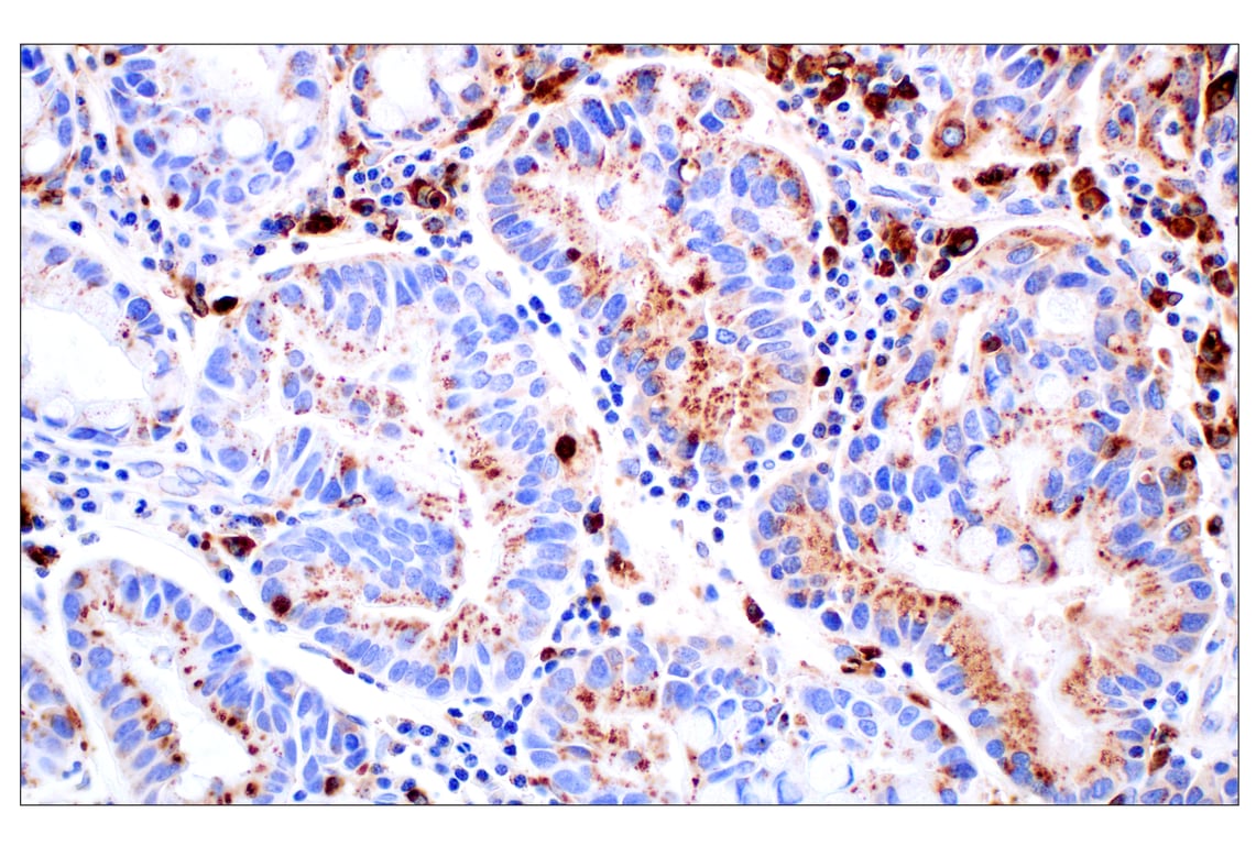 Immunohistochemistry Image 3: Cathepsin D (E5V4H) Rabbit mAb