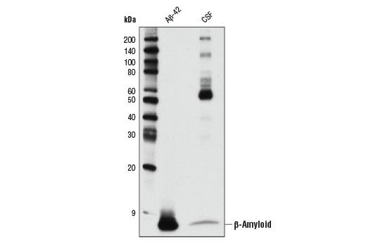 Western Blotting Image 3: β-Amyloid (D54D2) XP<sup>®</sup> Rabbit mAb