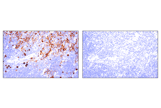 Immunohistochemistry Image 2: IL-2Rα/CD25 (E4B2Z) XP<sup>®</sup> Rabbit mAb (BSA and Azide Free)