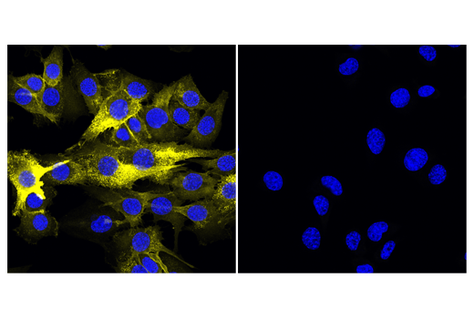 Immunofluorescence Image 1: CD44 (IM7) Rat mAb (Alexa Fluor<sup>®</sup> 555 Conjugate)