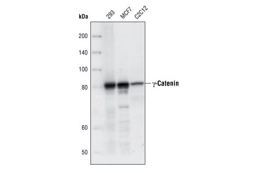 Western Blotting Image 1: γ-Catenin Antibody