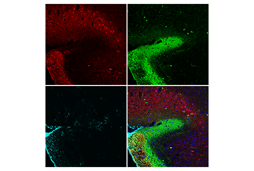 Immunofluorescence Image 4: Calretinin (E7R6O) XP<sup>®</sup> Rabbit mAb