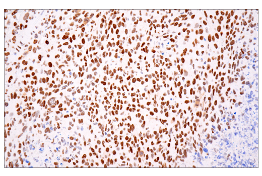 Immunohistochemistry Image 4: ATRX (E5X7O) Rabbit mAb (BSA and Azide Free)