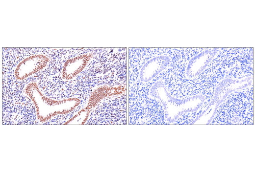 Immunohistochemistry Image 10: ATRX (E5X7O) Rabbit mAb (BSA and Azide Free)