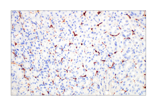undefined Image 34: Mouse Reactive M1 vs M2 Macrophage IHC Antibody Sampler Kit