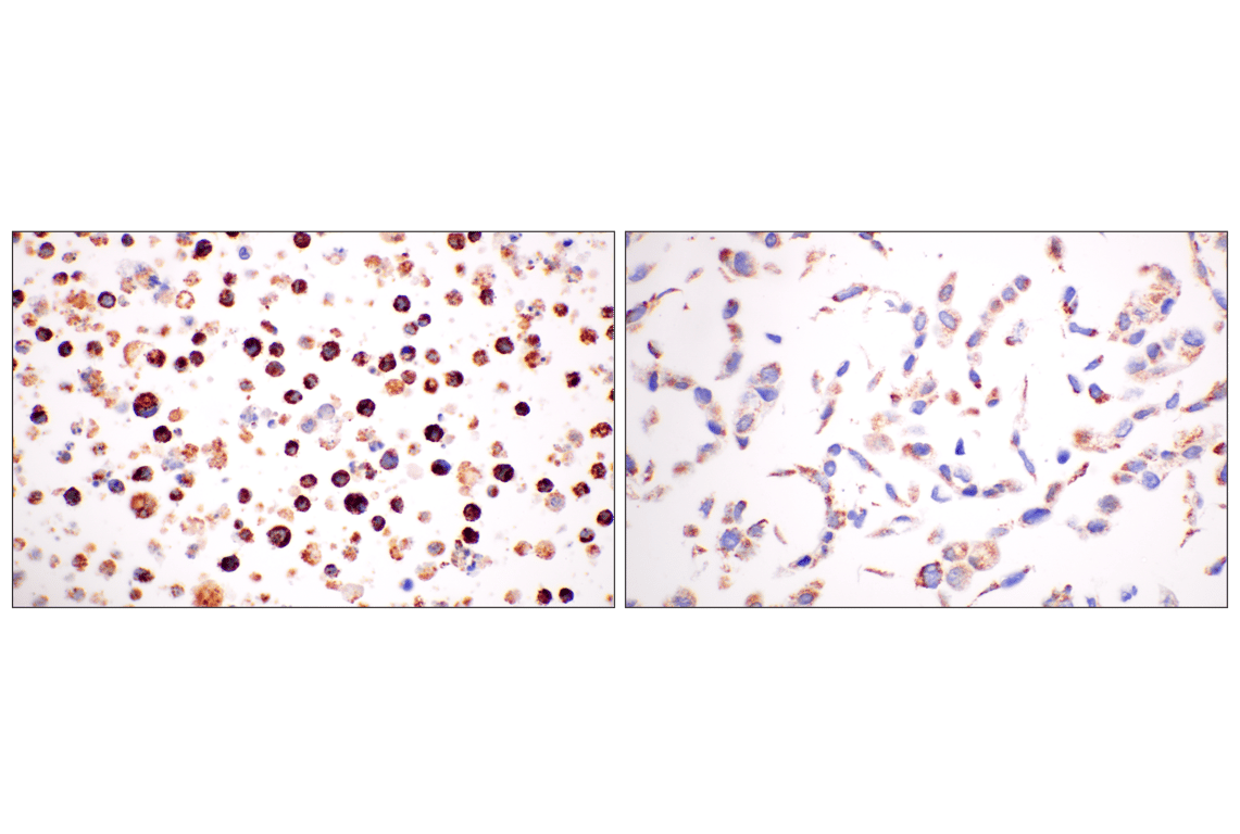 Immunohistochemistry Image 9: GCDH (F2P2M) Rabbit mAb